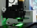 News: La proteina Ngf al centro di uno studio italo-cinese - Finanziamento di 3 milioni di euro per studiare le applicazioni contro le malattie neurodegenerative